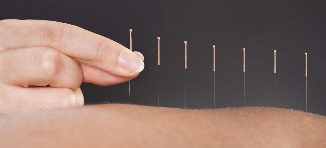 Tentang Kami - Perhimpunan Dokter Spesialis Akupunktur Medik Indonesia